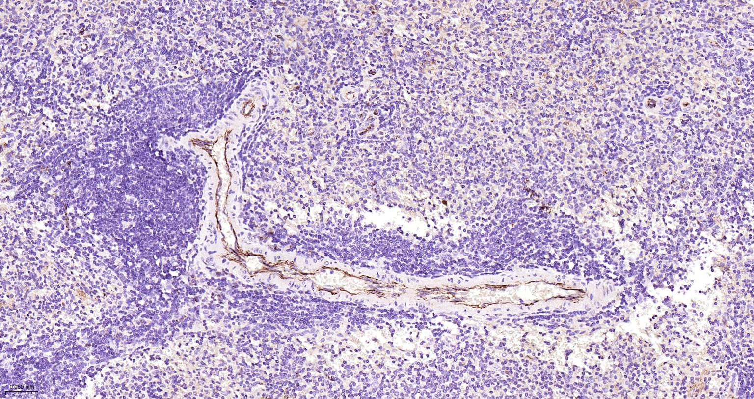 血小板内皮细胞黏附分子-1重组兔单抗