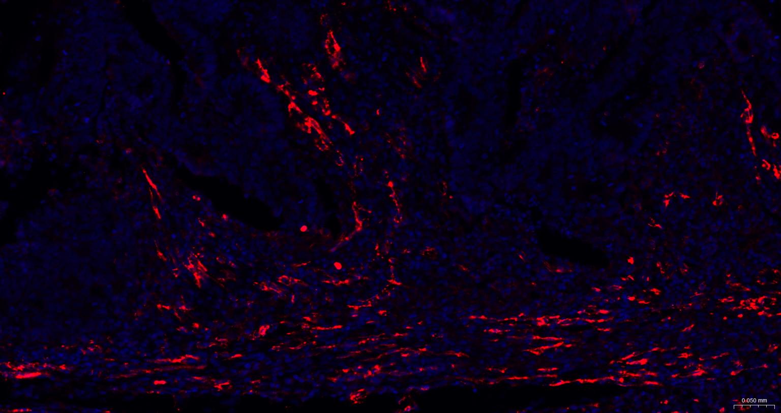 血小板内皮细胞黏附分子1单克隆抗体