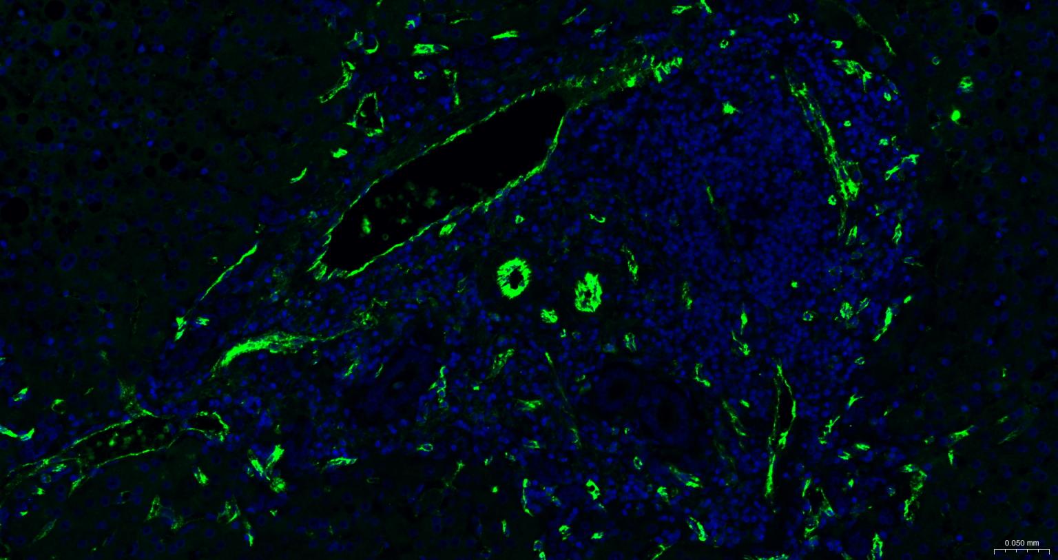 血小板内皮细胞黏附分子1单克隆抗体