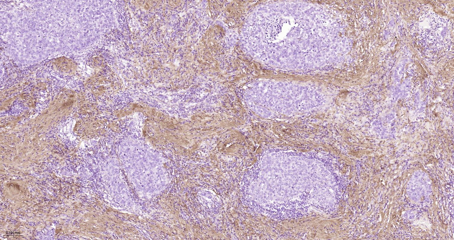 I型胶原蛋白/胶原蛋白1/1型胶原蛋白/I型胶原a1抗体