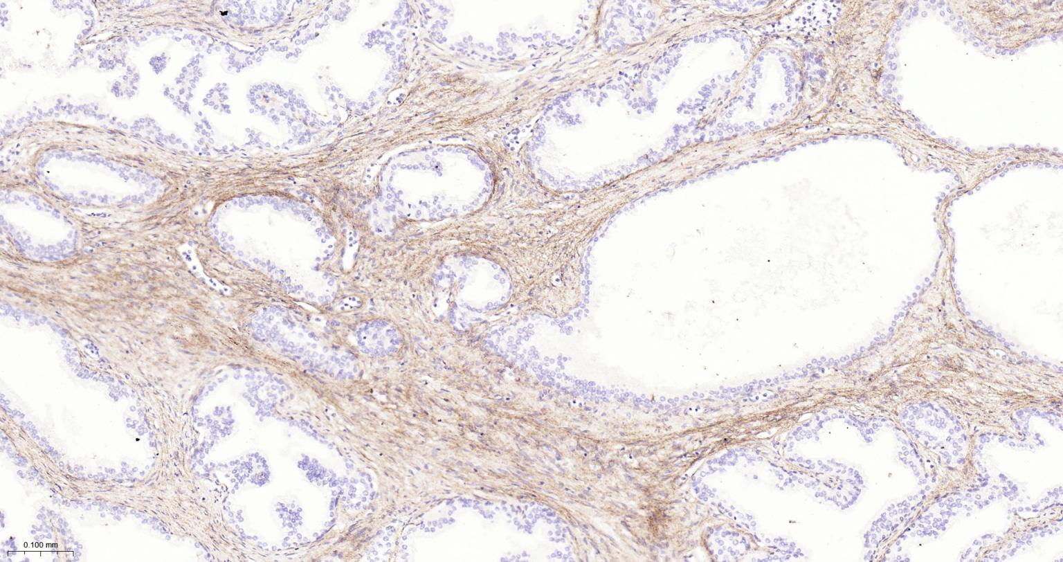 I型胶原重组兔单抗