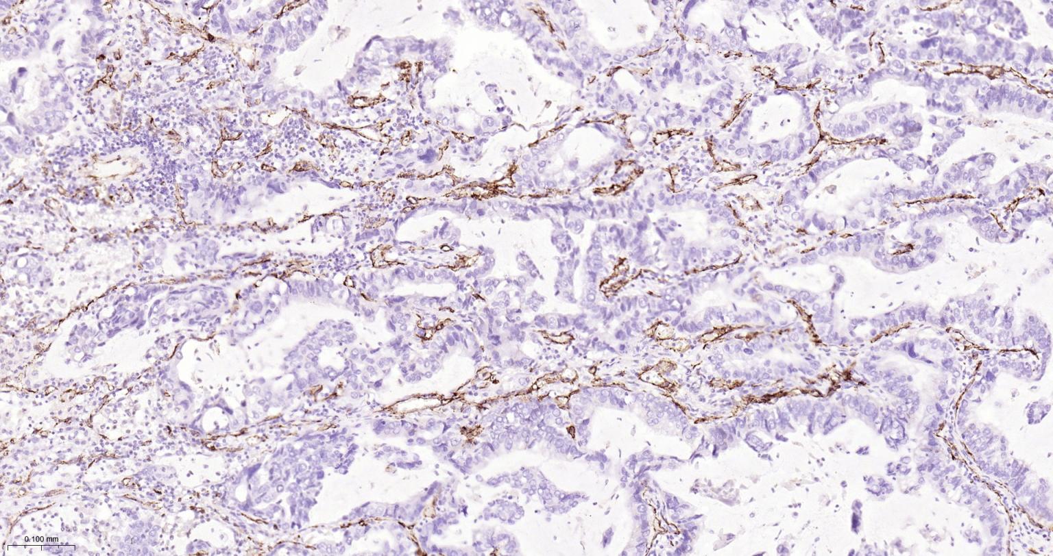 血小板内皮细胞黏附分子1单克隆抗体