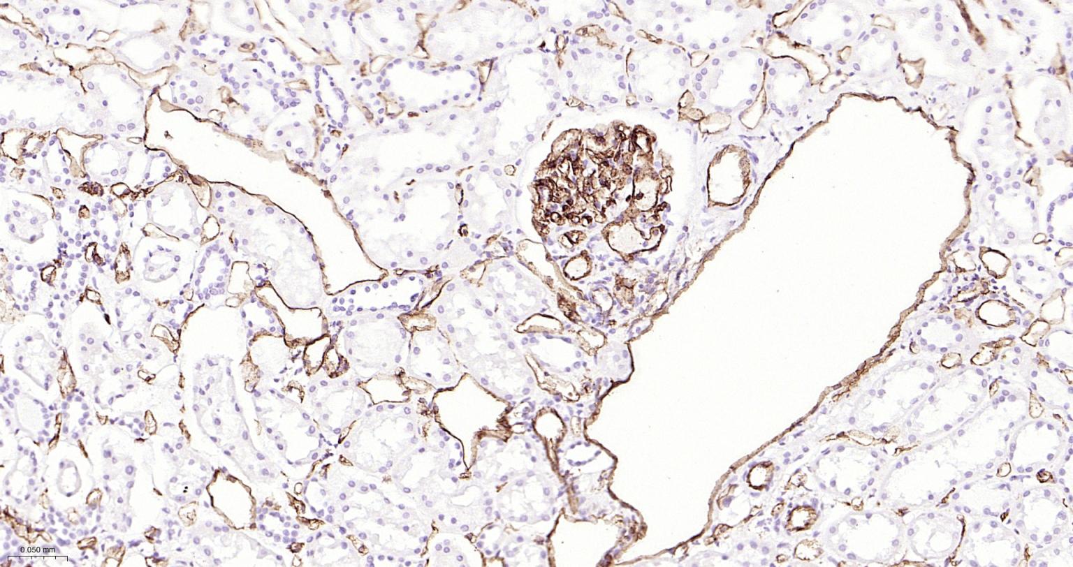 血小板内皮细胞黏附分子1单克隆抗体