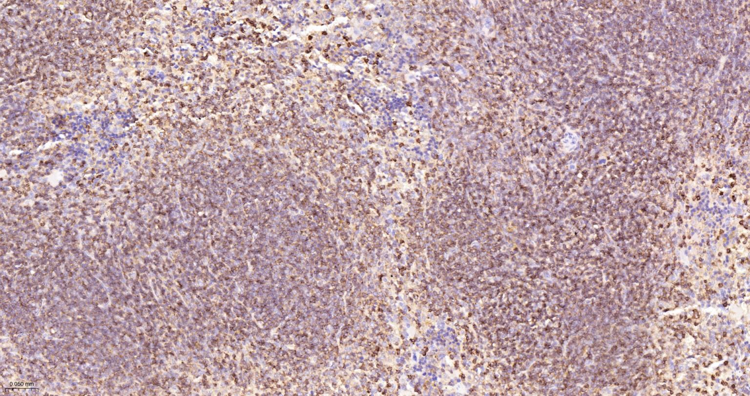 白细胞共同抗原抗体-bs-10602R