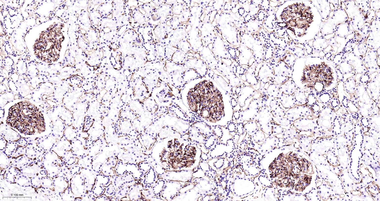 血小板内皮细胞黏附分子-1重组兔单抗
