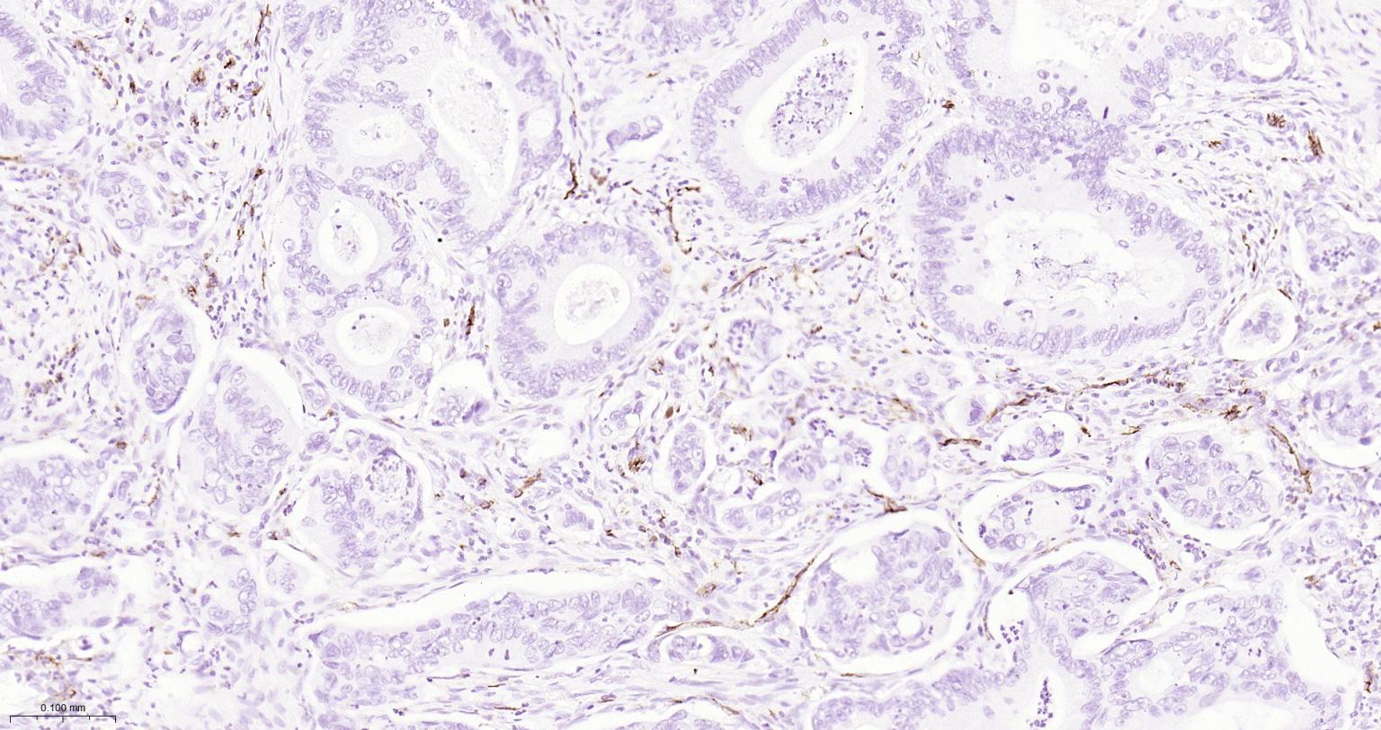 血小板内皮细胞黏附分子1单克隆抗体