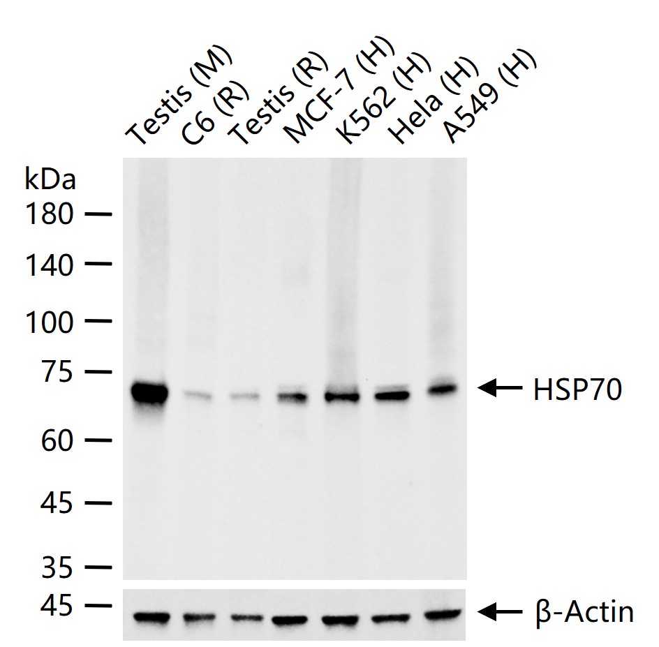 热休克蛋白-70重组兔单抗