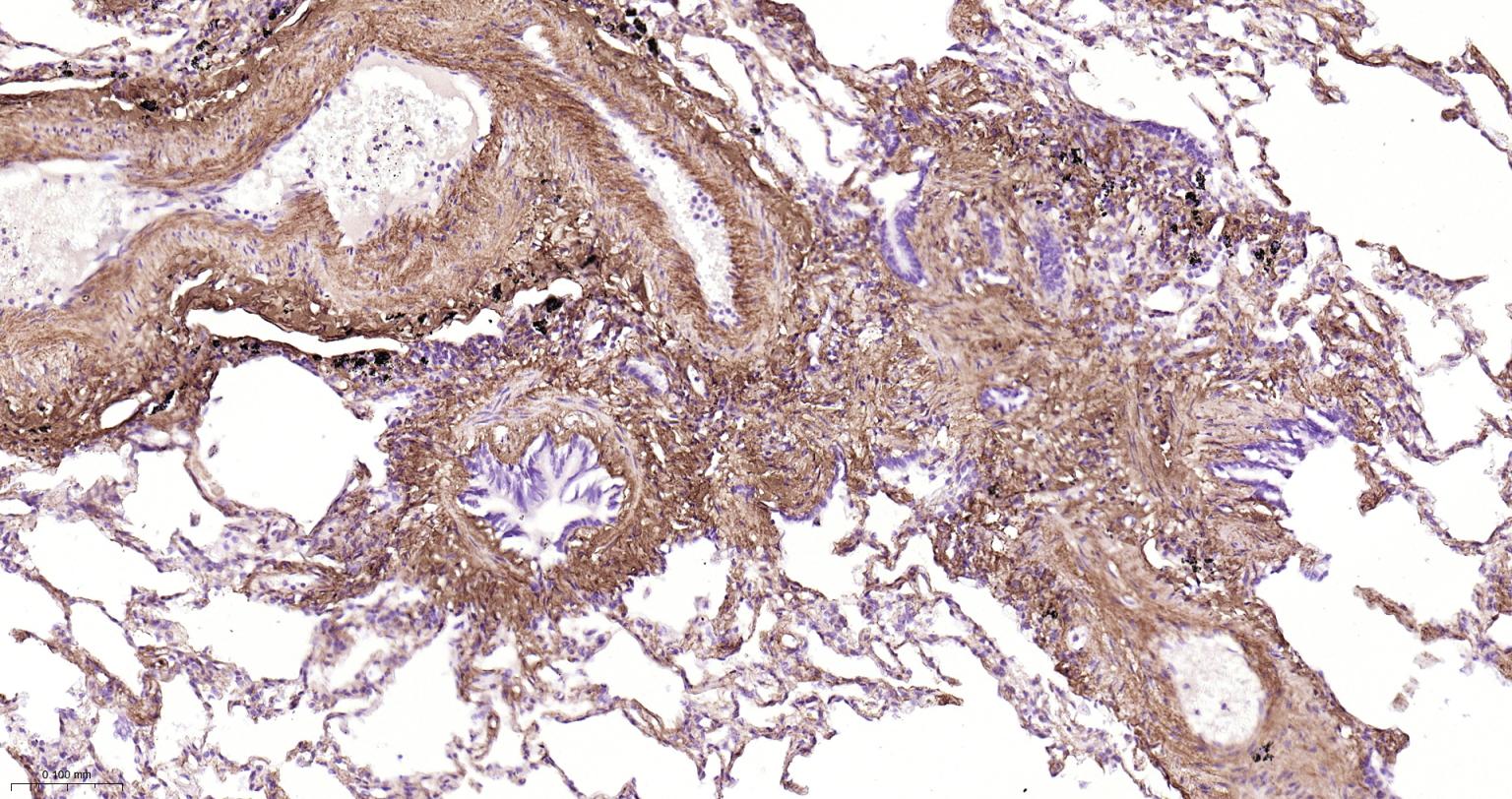 I型胶原蛋白/胶原蛋白1/1型胶原蛋白/I型胶原a1抗体