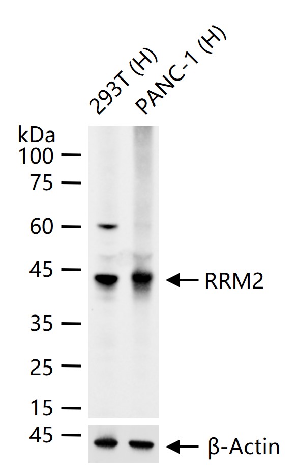 核糖核苷酸还原酶亚基R2重组小鼠单抗-bsm-60351M