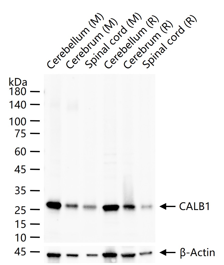 钙结合蛋白D28K重组兔单抗