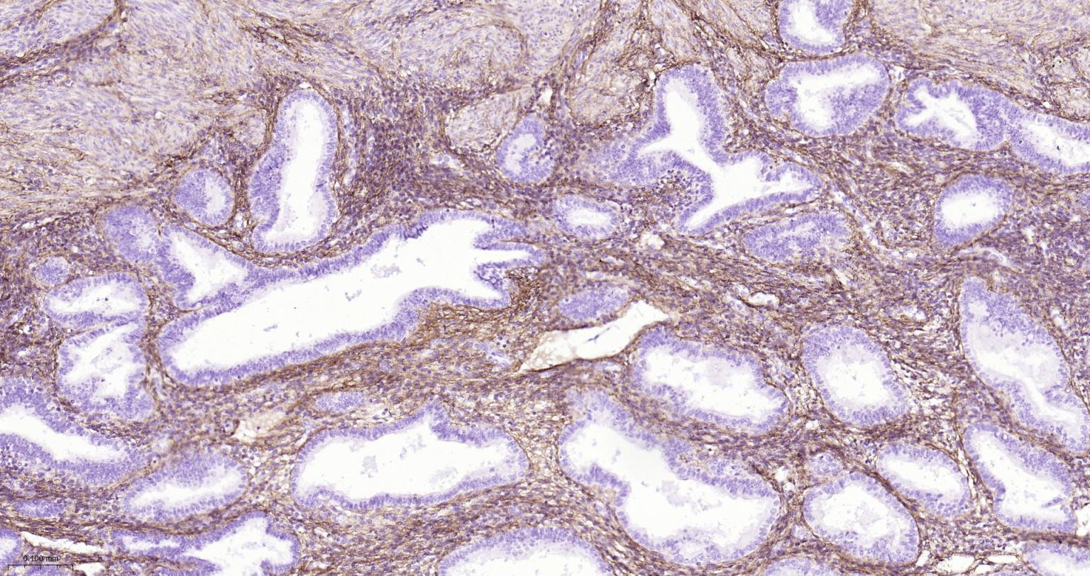 I型胶原蛋白/胶原蛋白1/1型胶原蛋白/I型胶原a1抗体