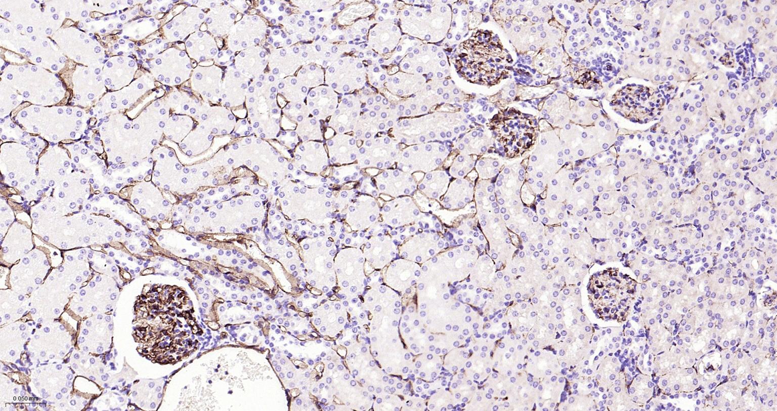 血小板内皮细胞黏附分子-1抗体
