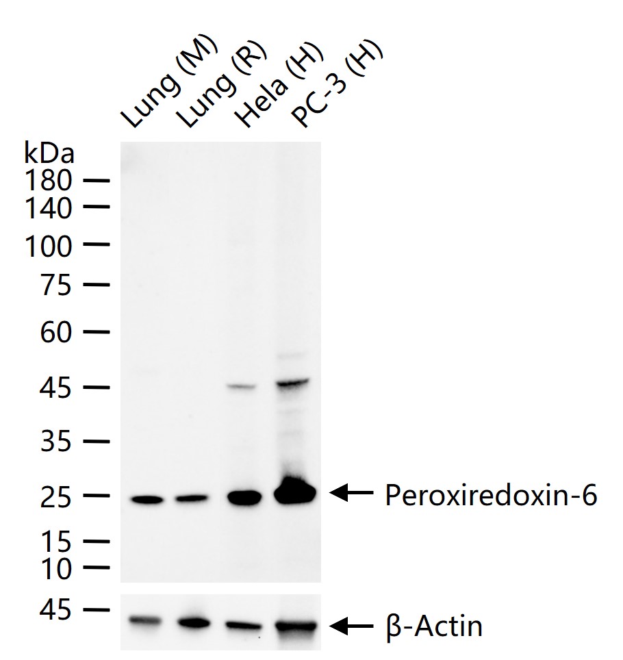 过氧化物还原酶6重组兔单抗