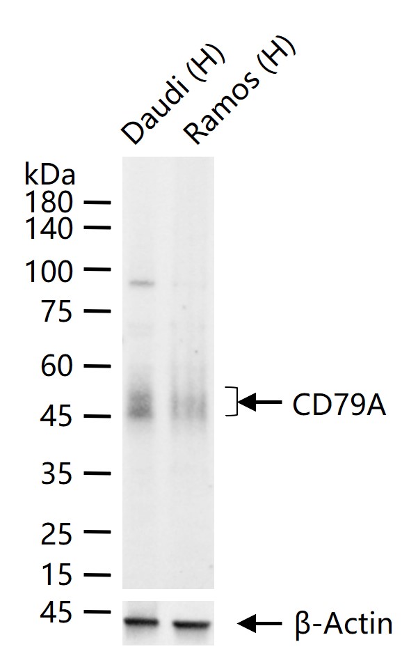 CD79A Rabbit pAb (一抗) - WB,IHC-P,IHC-F,IF,ELISA | Bioss