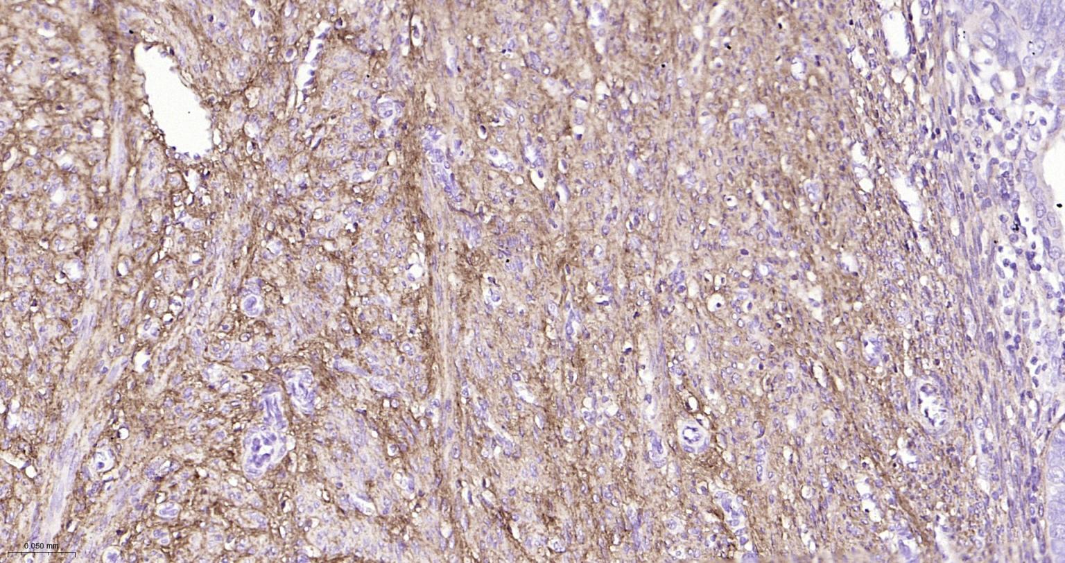 I型胶原蛋白/胶原蛋白1/1型胶原蛋白/I型胶原a1抗体