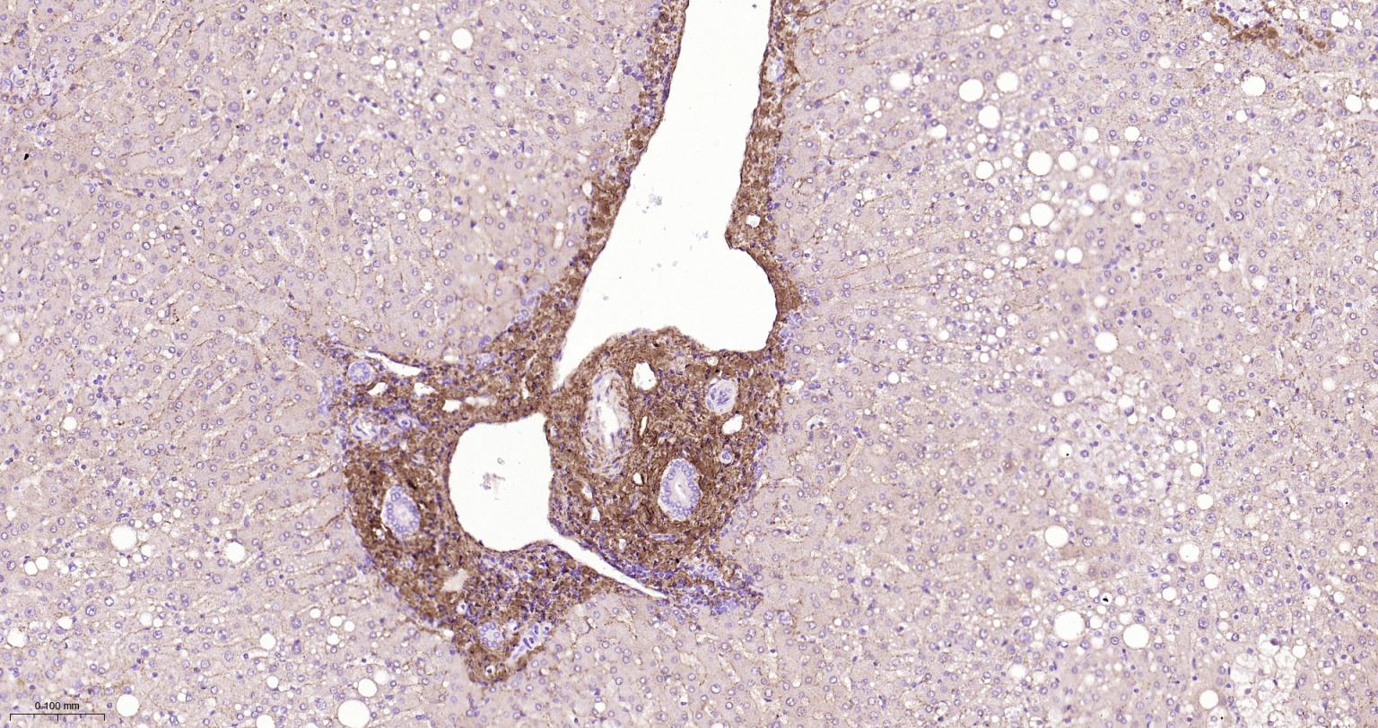 I型胶原蛋白/胶原蛋白1/1型胶原蛋白/I型胶原a1抗体