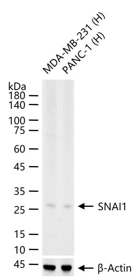 SNAI1 Recombinant Rabbit mAb (一抗) - WB,Flow-Cyt | Bioss