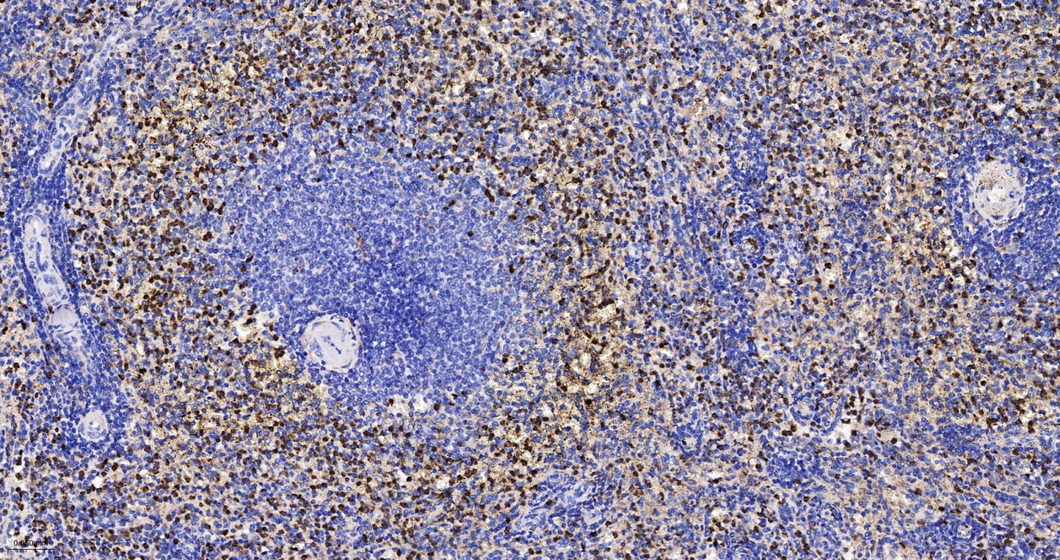 黑色素瘤相关抗原重组兔单抗