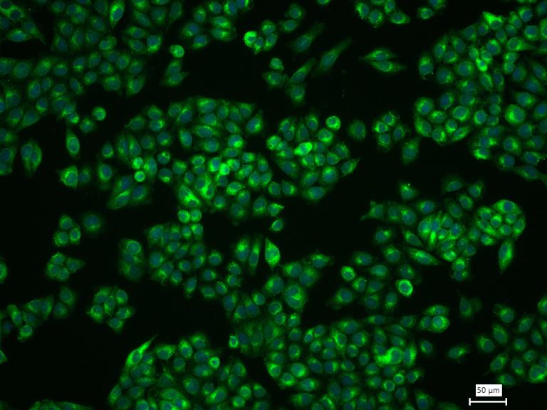 黑色素瘤相关抗原重组兔单抗