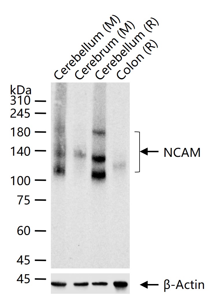 神经细胞粘附分子1重组兔单抗