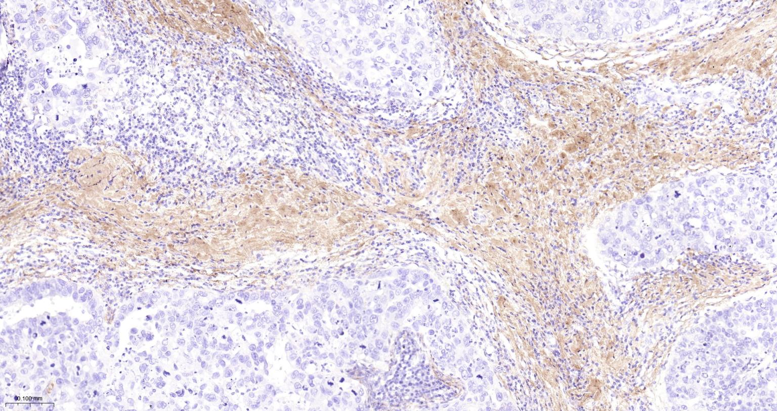 I型胶原重组兔单抗