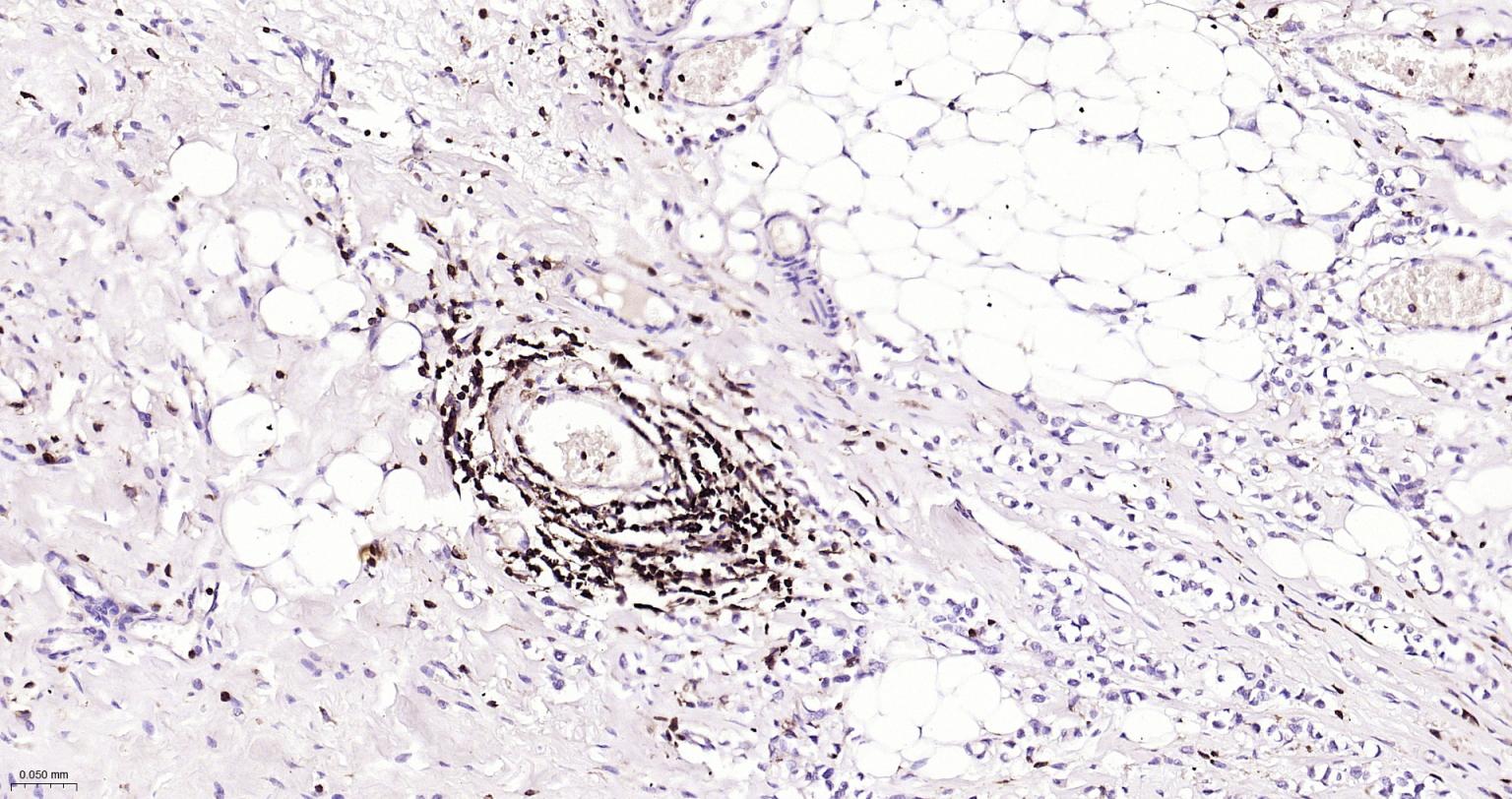白细胞共同抗原CD45重组兔单抗