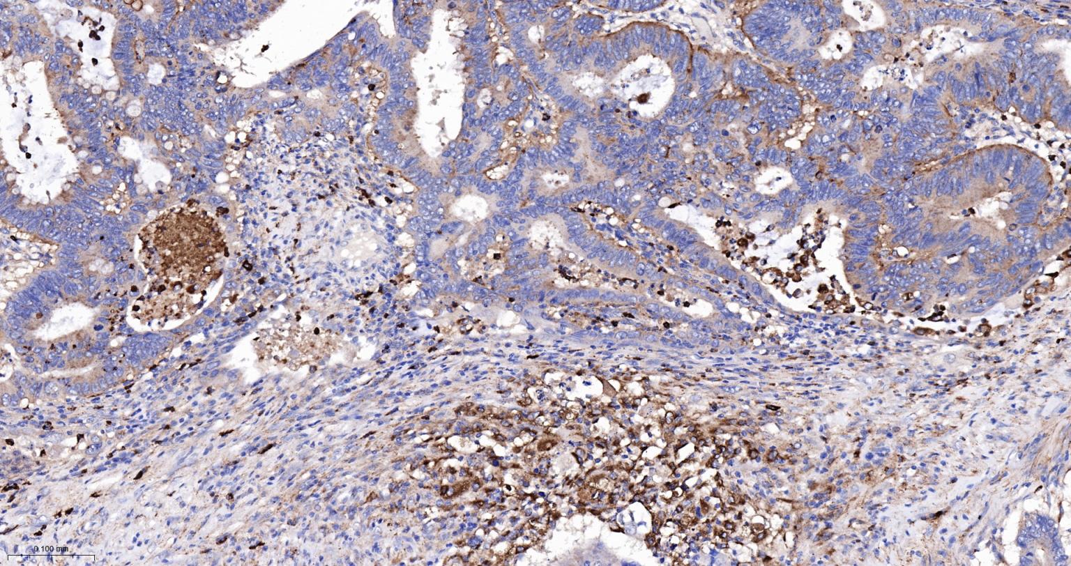 黑色素瘤相关抗原重组兔单抗