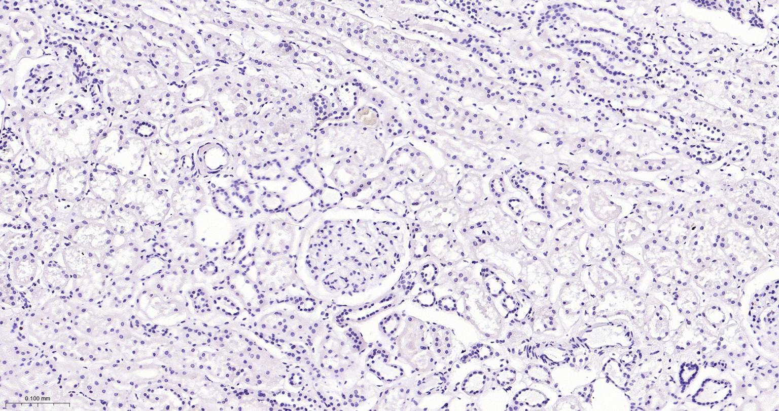 白细胞共同抗原CD45重组兔单抗