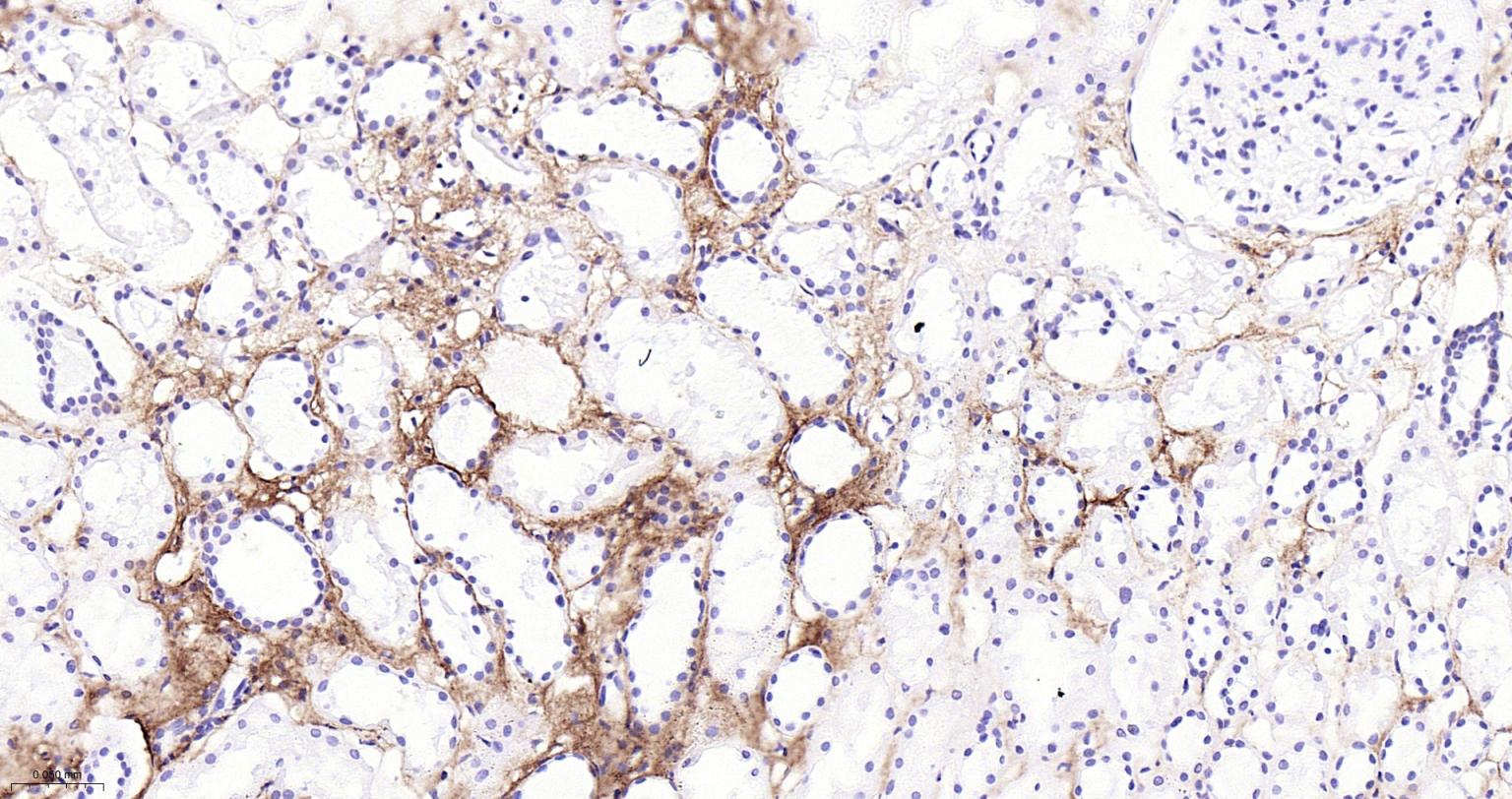 I型胶原重组兔单抗