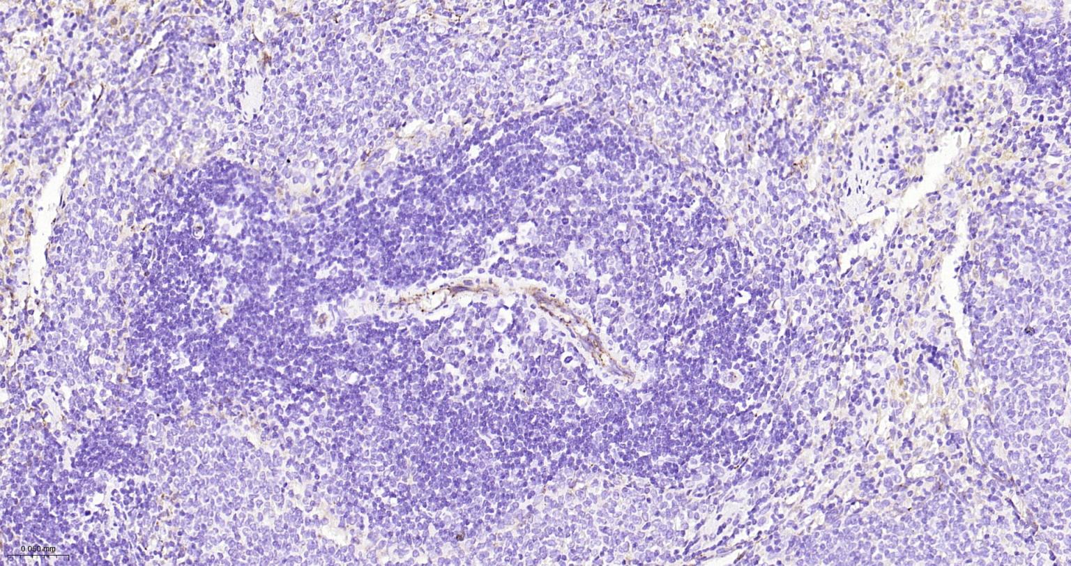 血小板内皮细胞黏附分子-1抗体