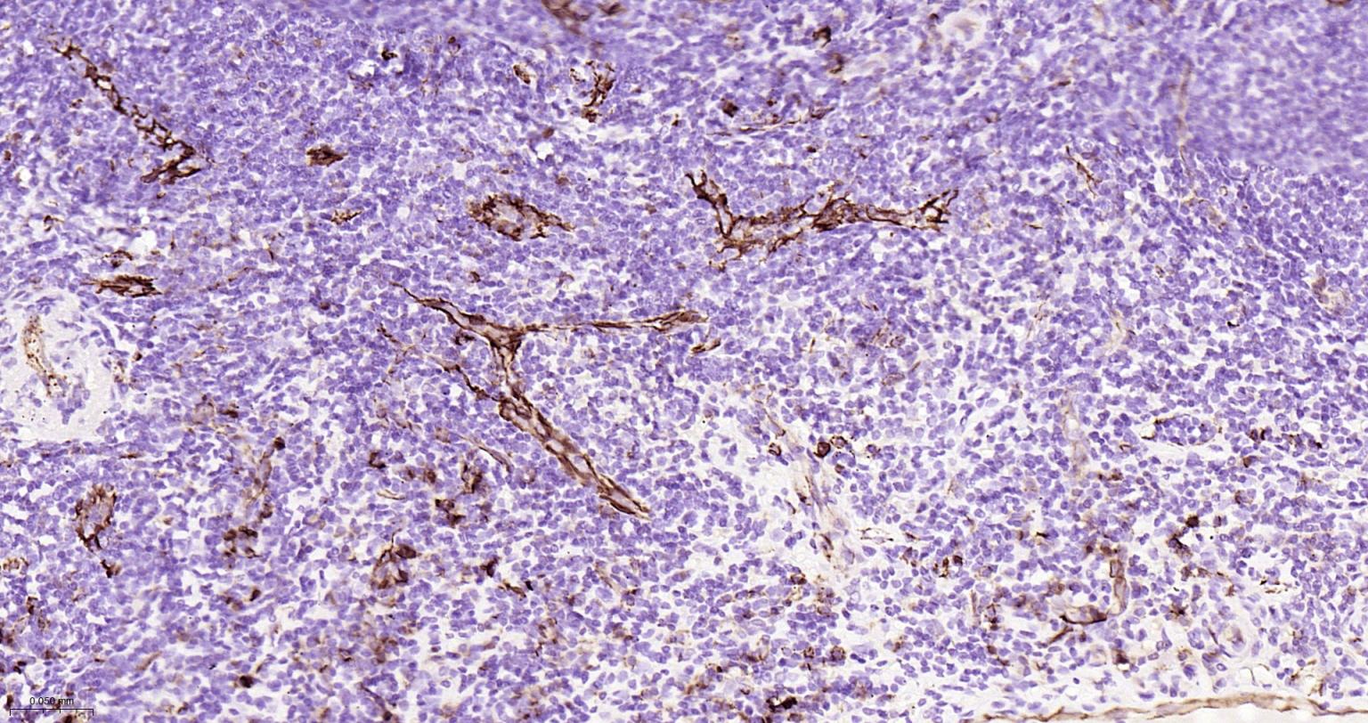 血小板内皮细胞黏附分子1单克隆抗体