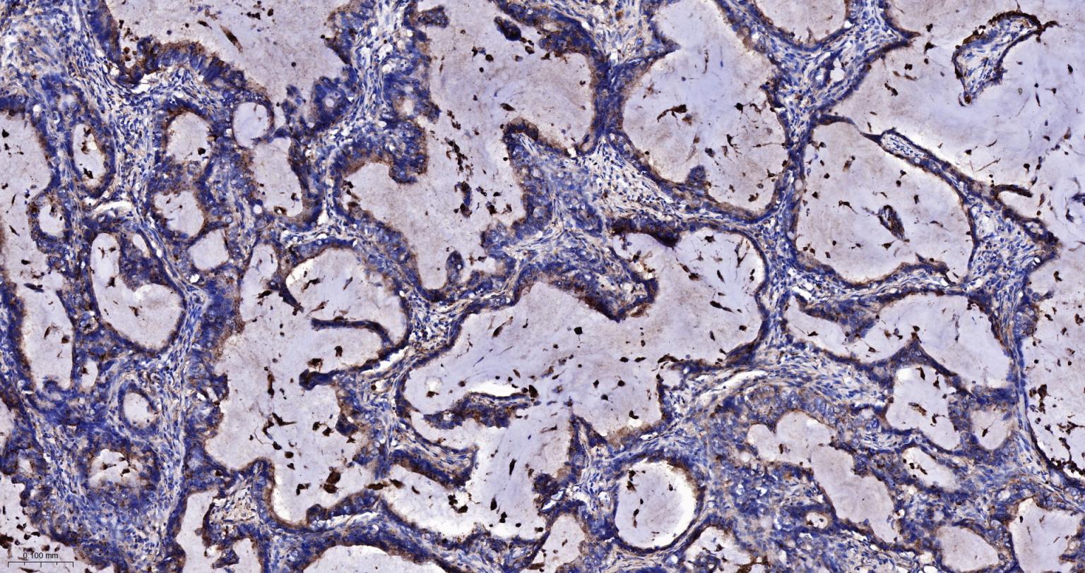 黑色素瘤相关抗原重组兔单抗
