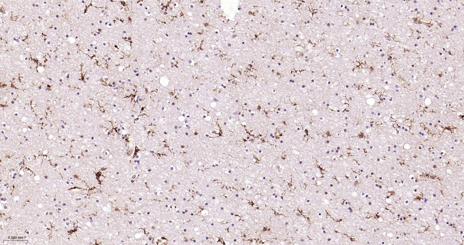 离子钙接头蛋白单克隆抗体-bsm-54132R