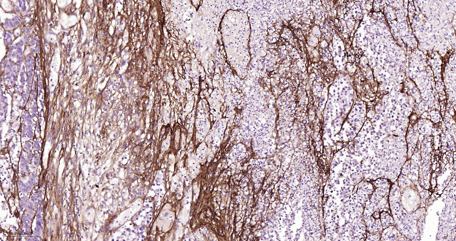 I型胶原蛋白/胶原蛋白1/1型胶原蛋白/I型胶原a1抗体