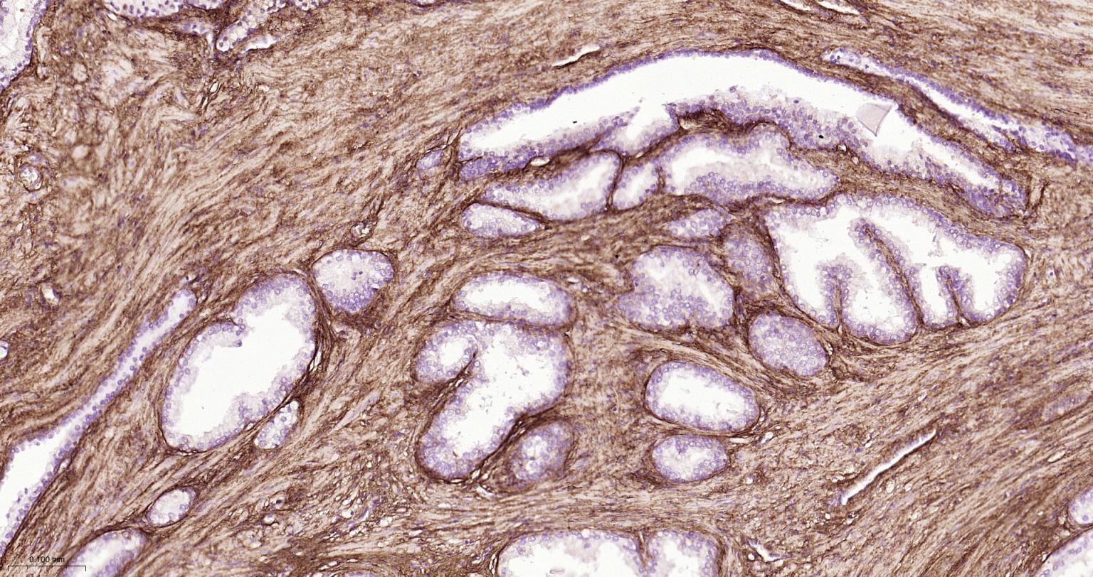 I型胶原蛋白/胶原蛋白1/1型胶原蛋白/I型胶原a1抗体