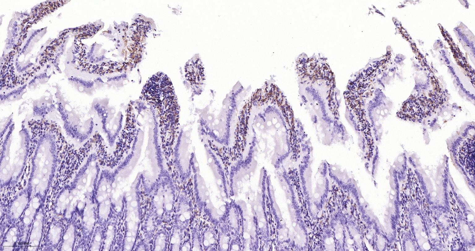 离子钙接头蛋白单克隆抗体-bsm-54132R