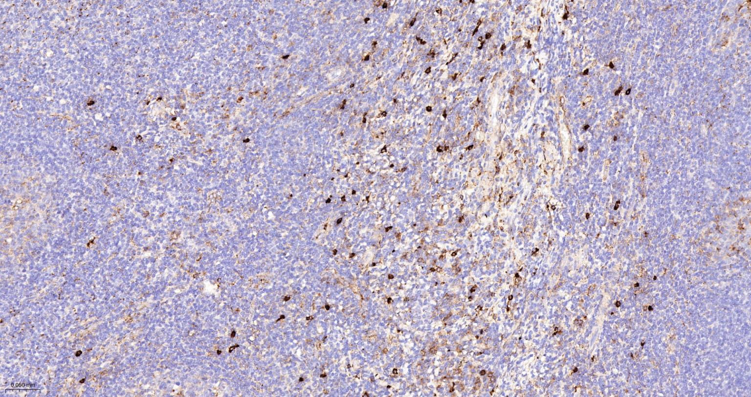 黑色素瘤相关抗原重组兔单抗