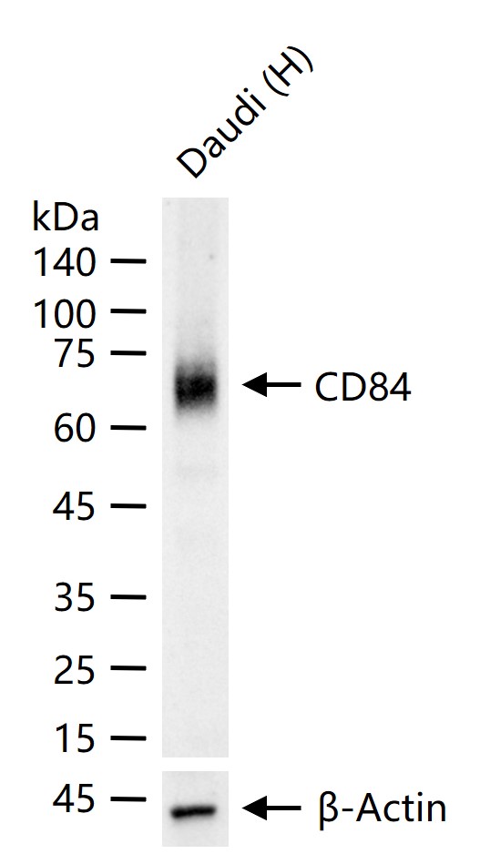 CD84重组兔单抗