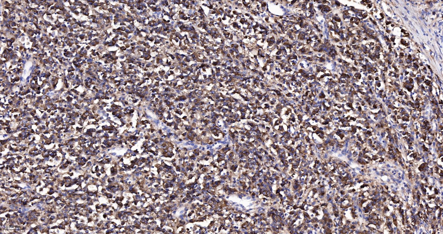 黑色素瘤相关抗原重组兔单抗