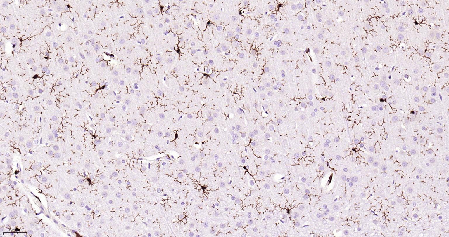 离子钙接头蛋白单克隆抗体-bsm-54132R