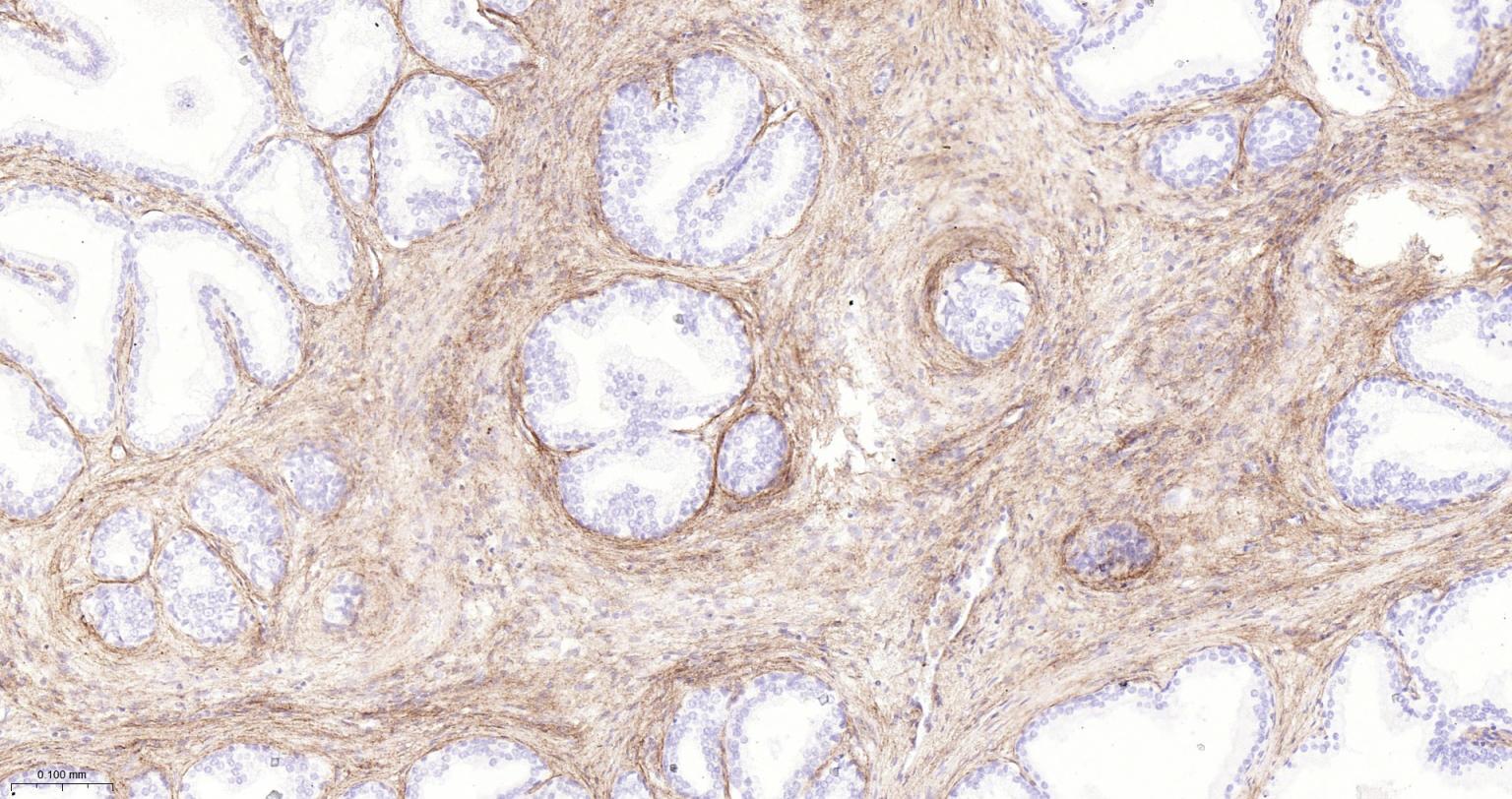 I型胶原重组兔单抗