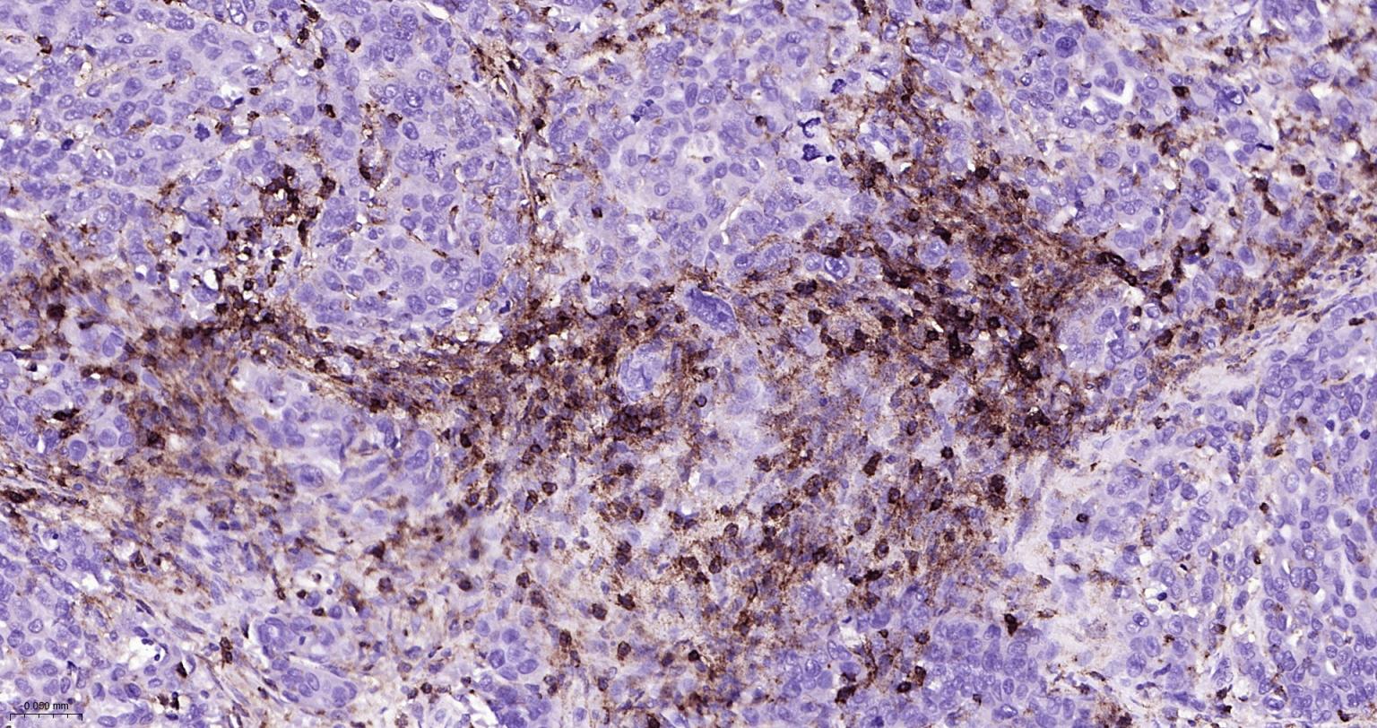 白细胞共同抗原CD45重组兔单抗