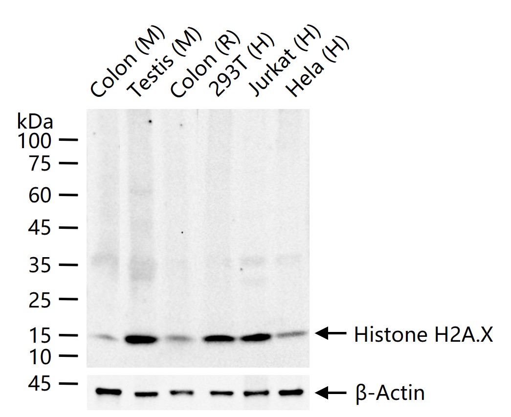 组蛋白H2AX重组兔单抗