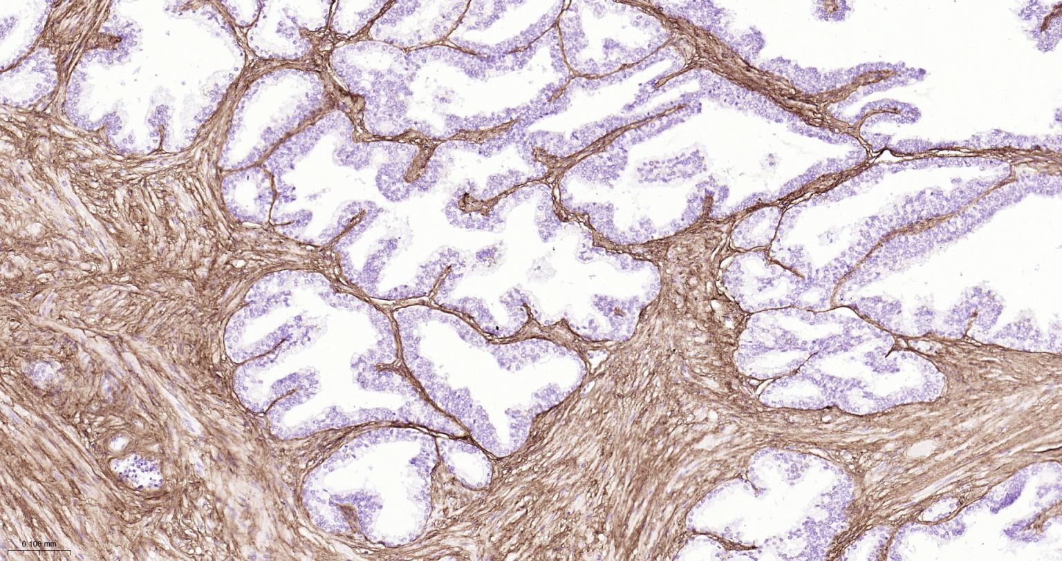I型胶原蛋白/胶原蛋白1/1型胶原蛋白/I型胶原a1抗体