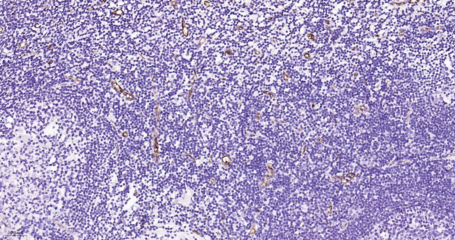 血小板内皮细胞黏附分子-1重组兔单抗