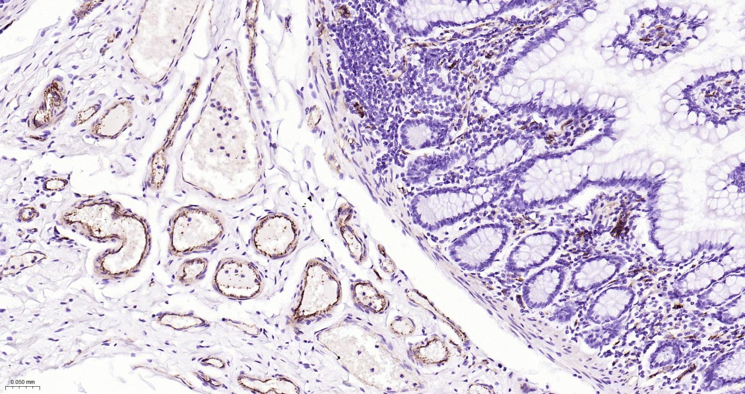 血小板内皮细胞黏附分子-1重组兔单抗