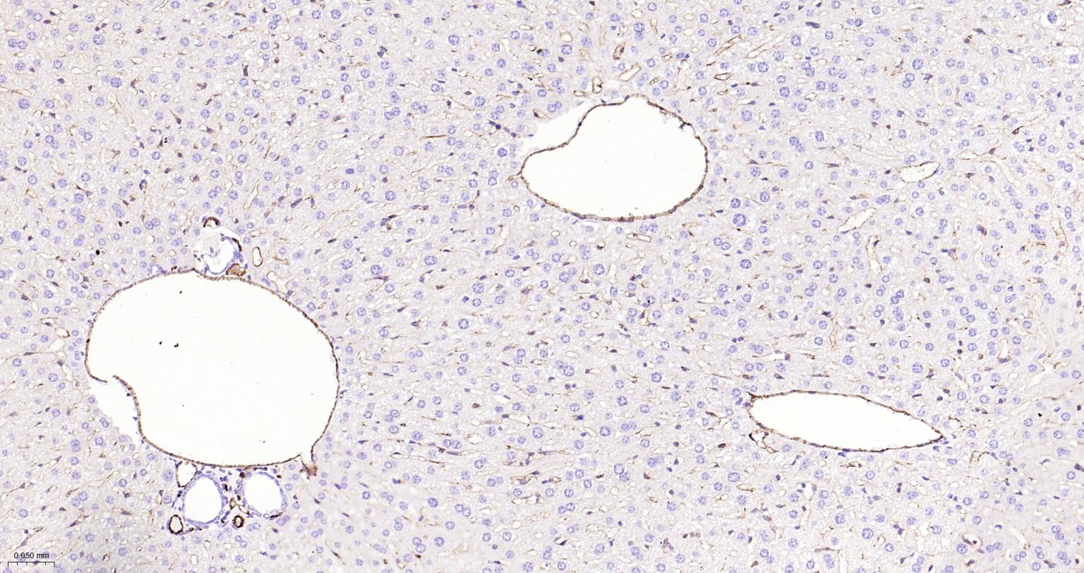 血小板内皮细胞黏附分子-1抗体