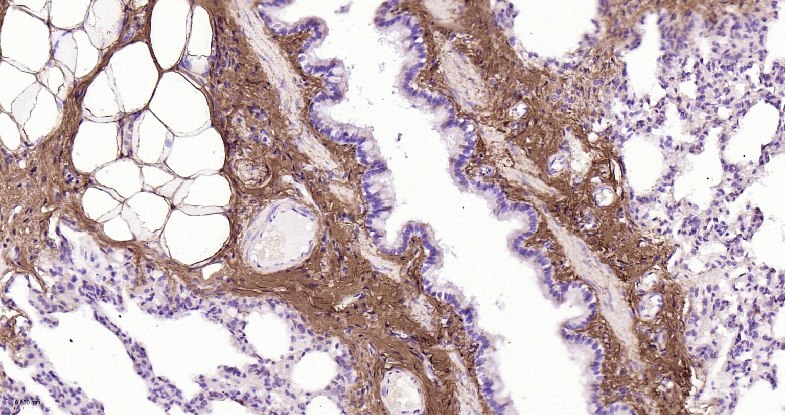 I型胶原蛋白/胶原蛋白1/1型胶原蛋白/I型胶原a1抗体