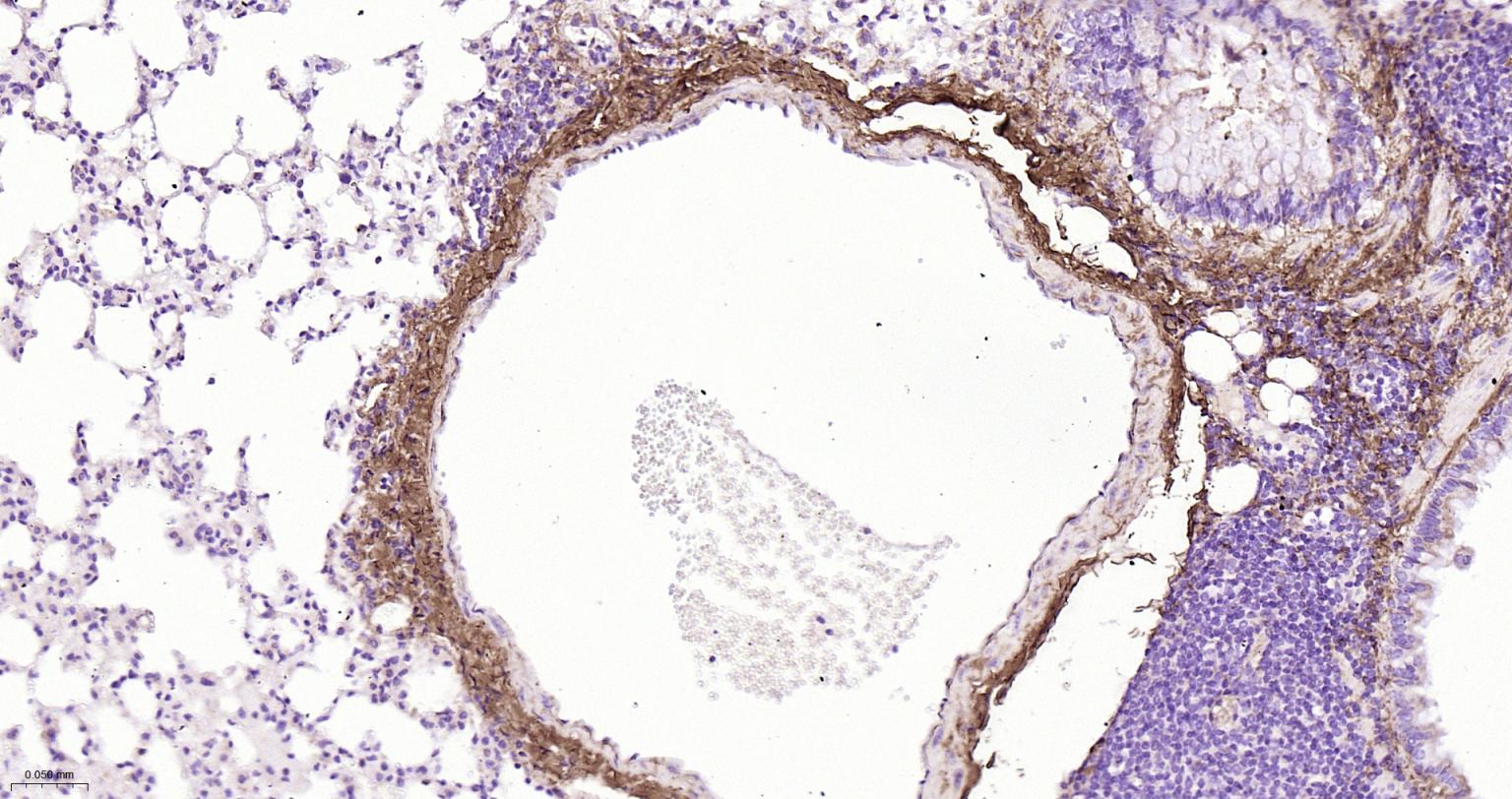 I型胶原蛋白/胶原蛋白1/1型胶原蛋白/I型胶原a1抗体