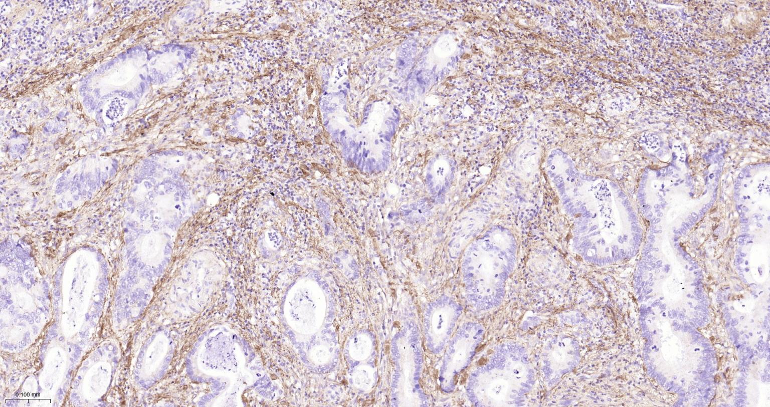 I型胶原重组兔单抗